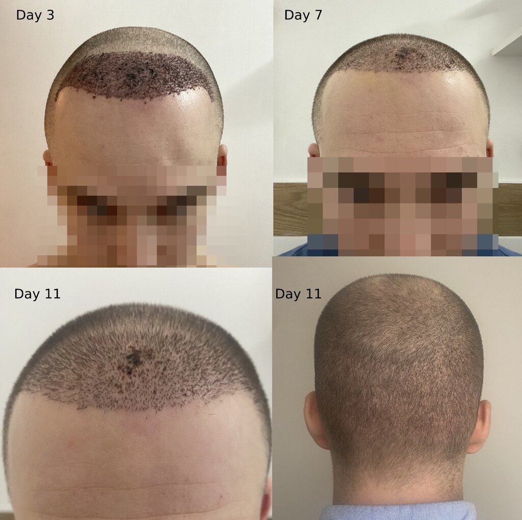 /foren/transplant/index.php/fa/56836/0/