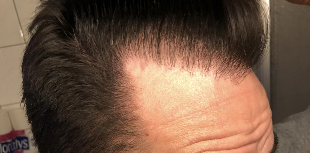 /foren/transplant/index.php/fa/56886/0/