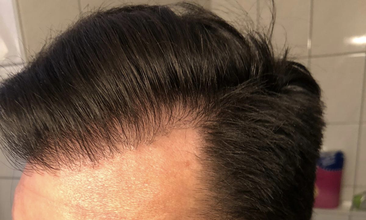 /foren/transplant/index.php/fa/56887/0/