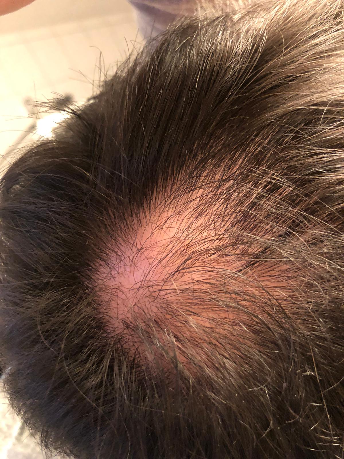 /foren/transplant/index.php/fa/56888/0/