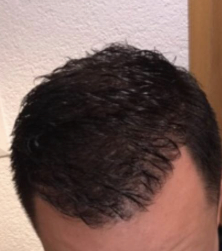 /foren/transplant/index.php/fa/56890/0/