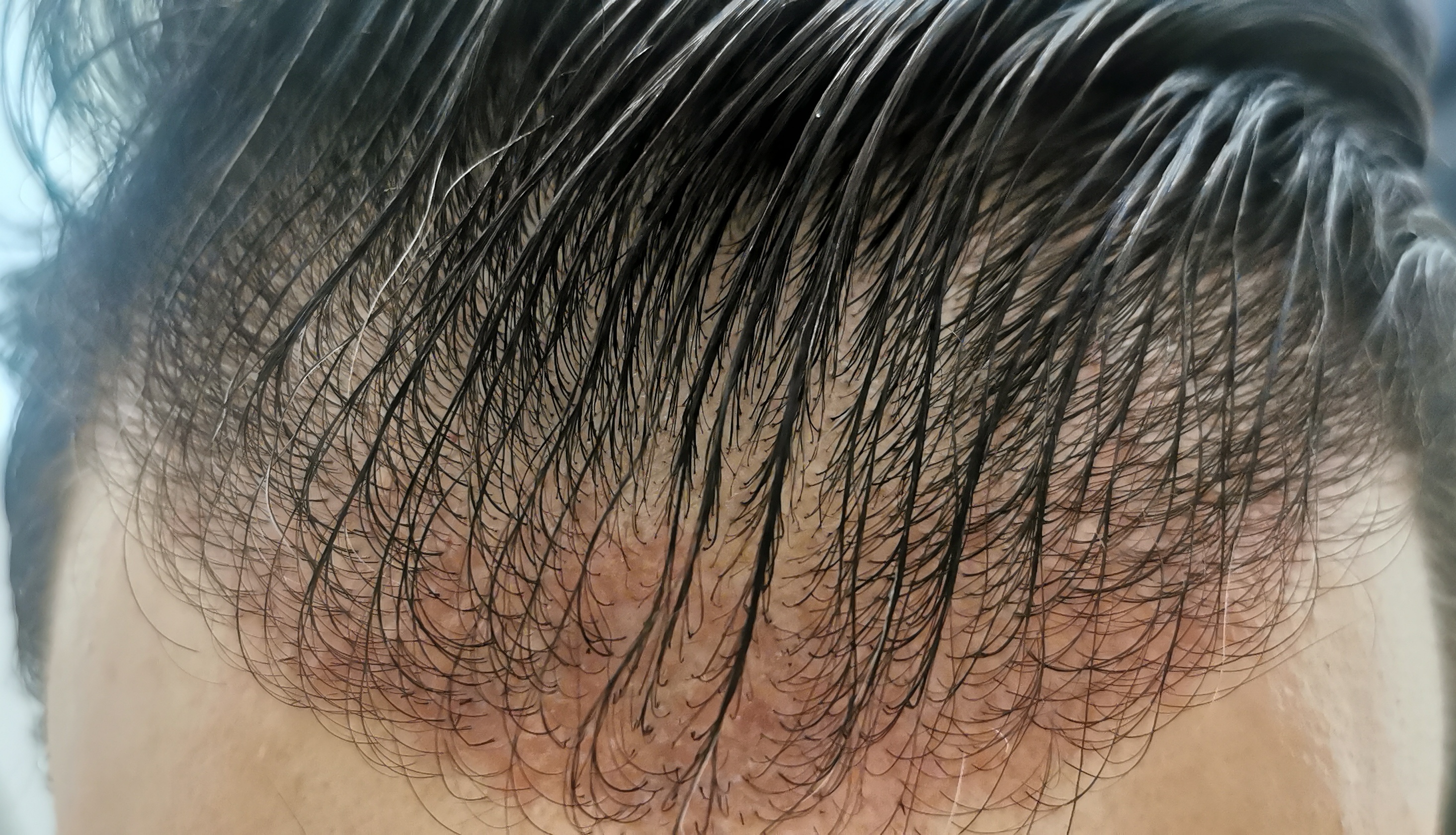 /foren/transplant/index.php/fa/56964/0/