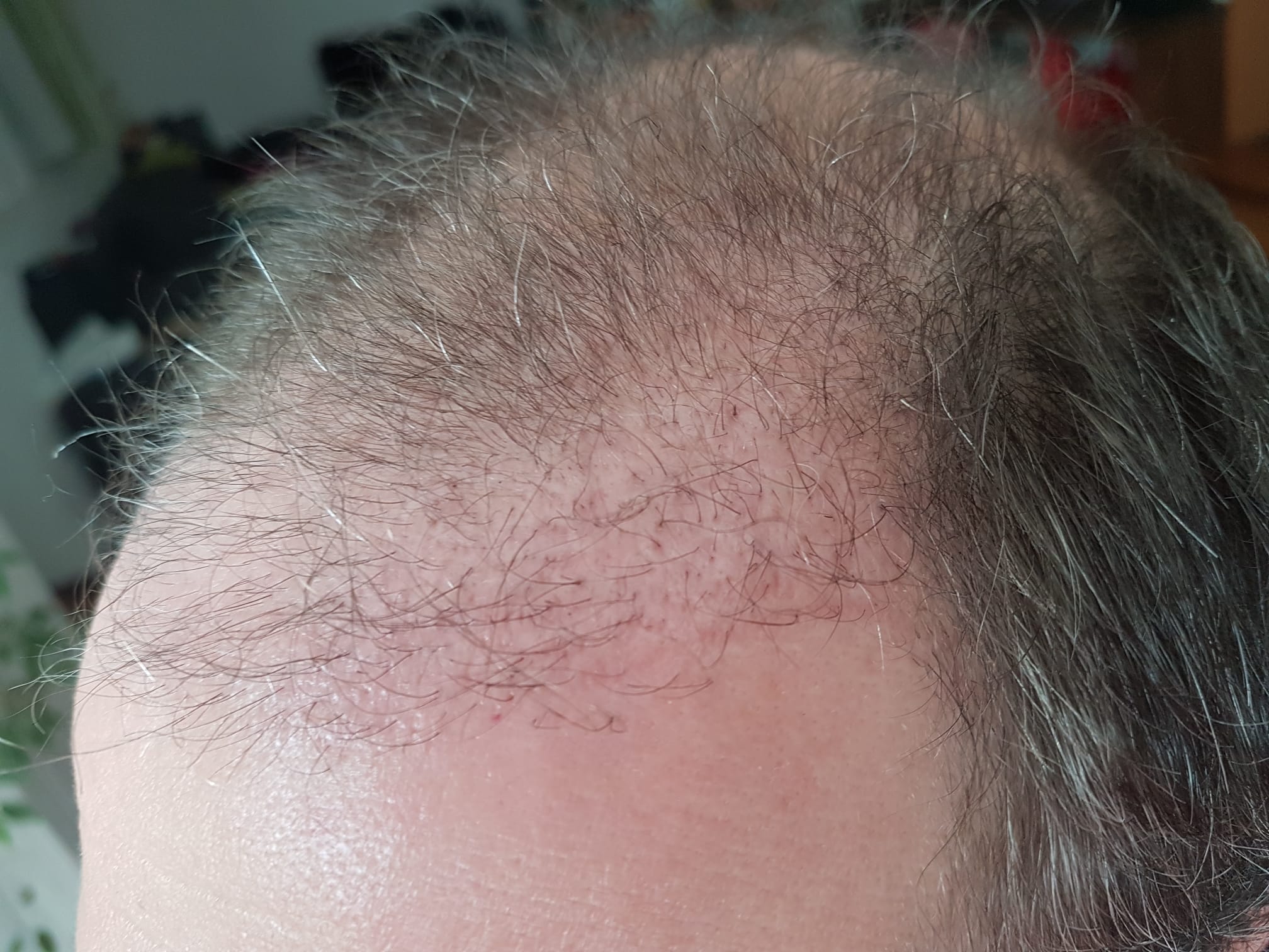 /foren/transplant/index.php/fa/57008/0/