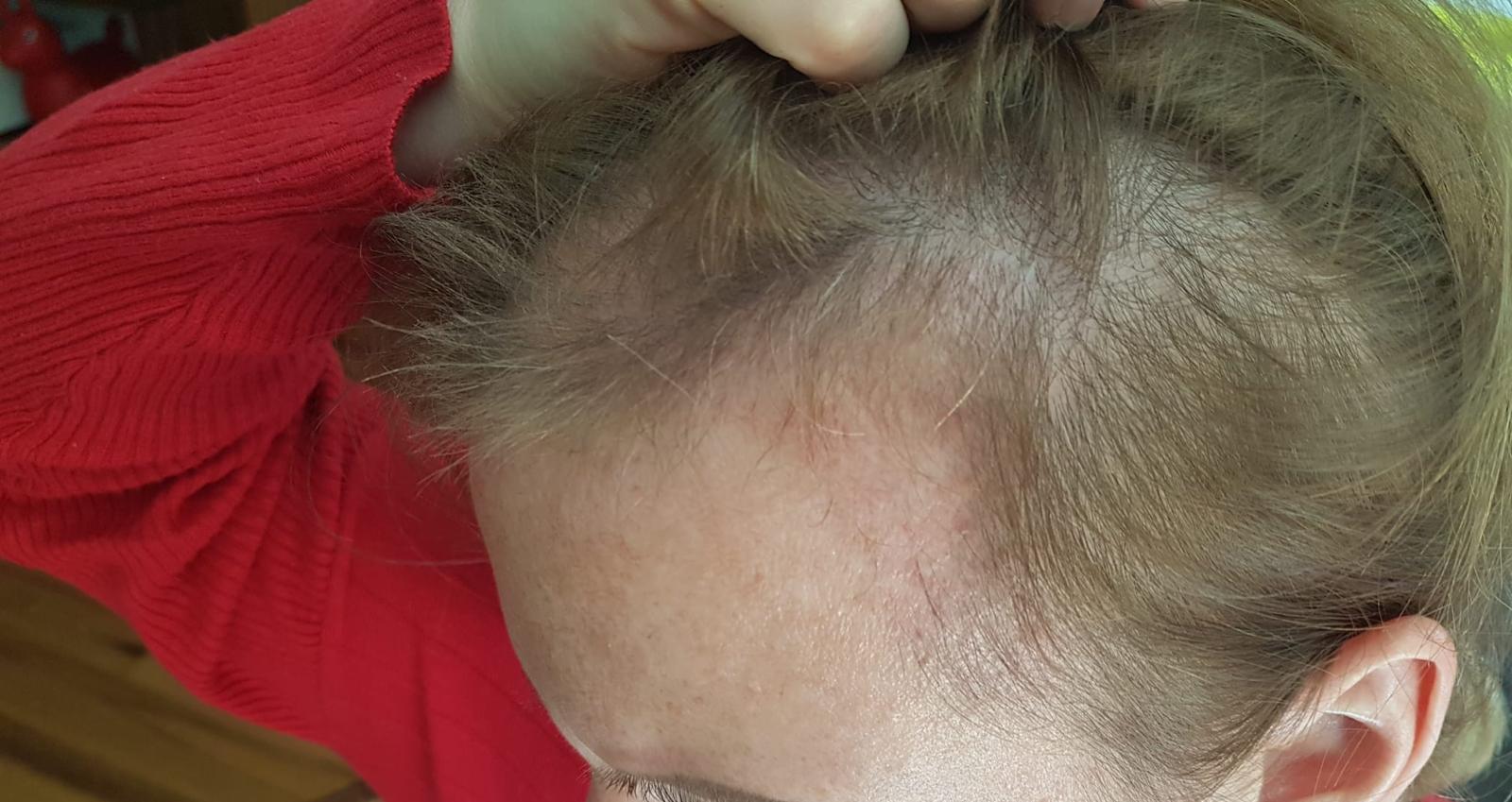 /foren/transplant/index.php/fa/57009/0/