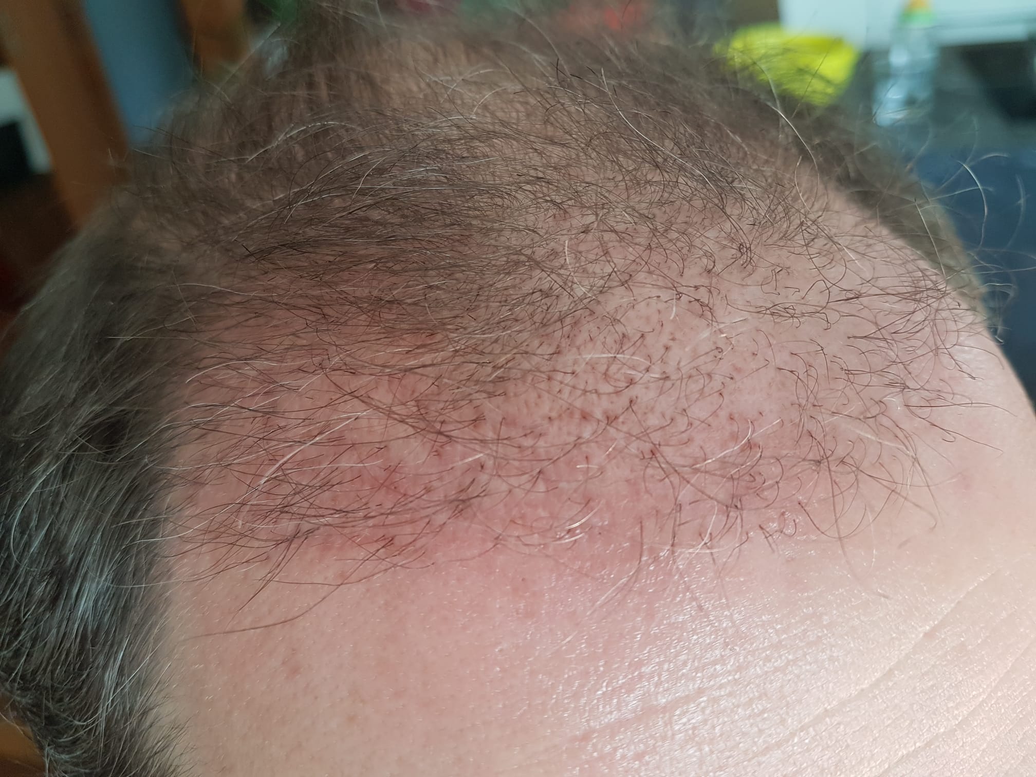 /foren/transplant/index.php/fa/57010/0/