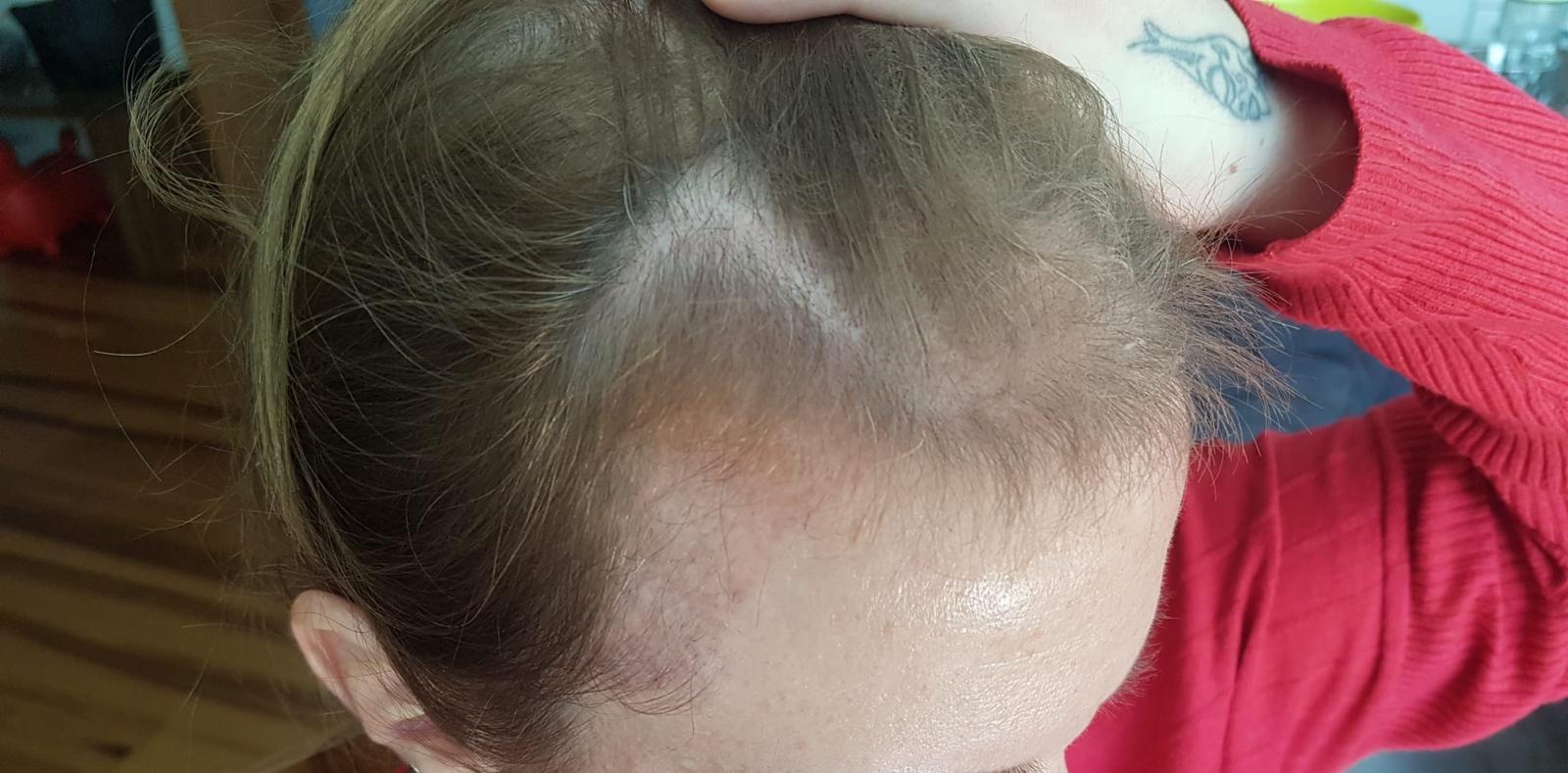 /foren/transplant/index.php/fa/57011/0/