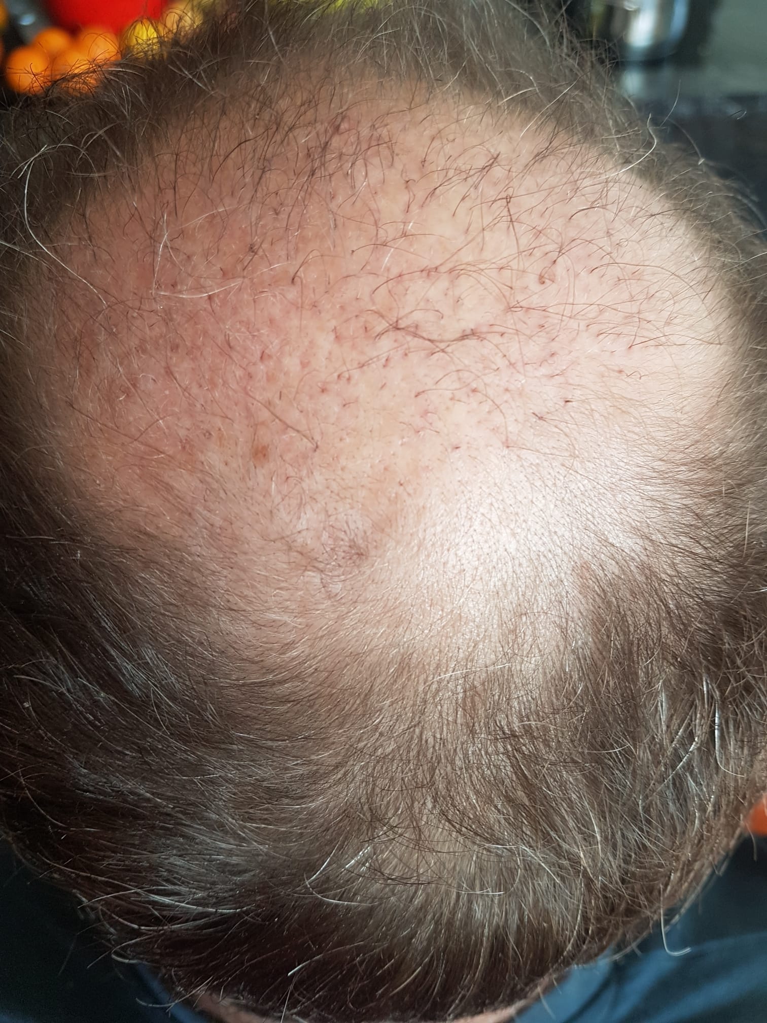 /foren/transplant/index.php/fa/57012/0/