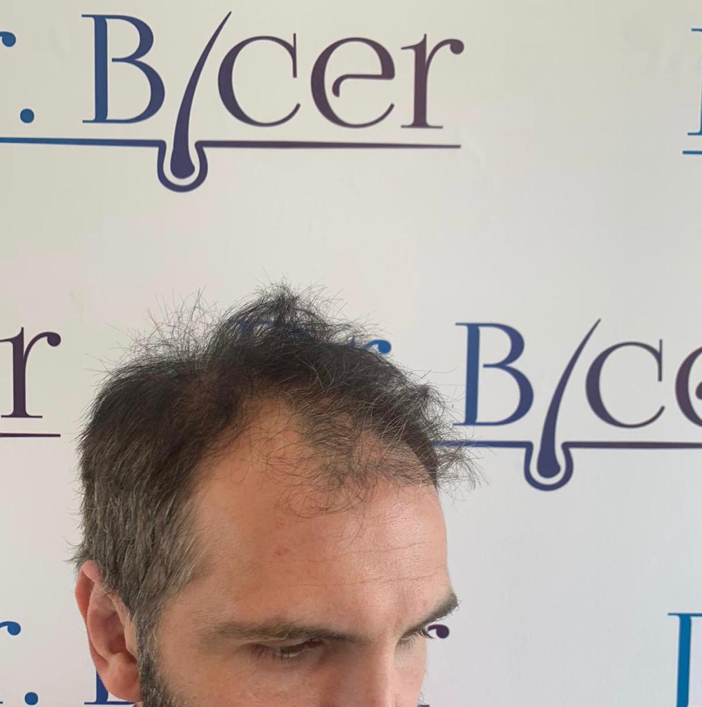 /foren/transplant/index.php/fa/57023/0/