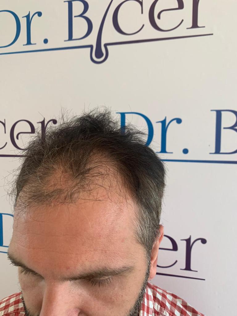 /foren/transplant/index.php/fa/57024/0/