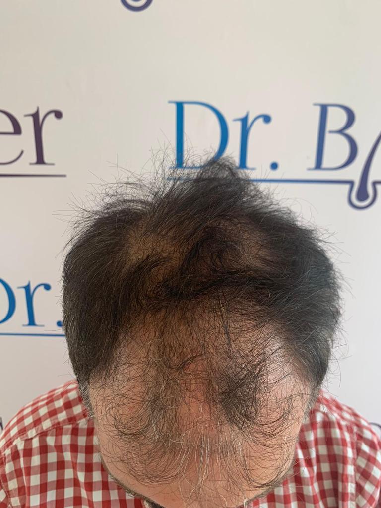 /foren/transplant/index.php/fa/57025/0/