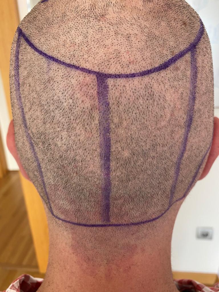 /foren/transplant/index.php/fa/57026/0/