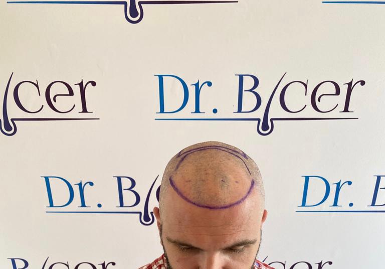 /foren/transplant/index.php/fa/57027/0/