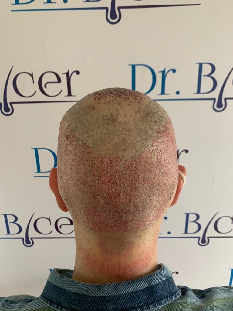 /foren/transplant/index.php/fa/57029/0/