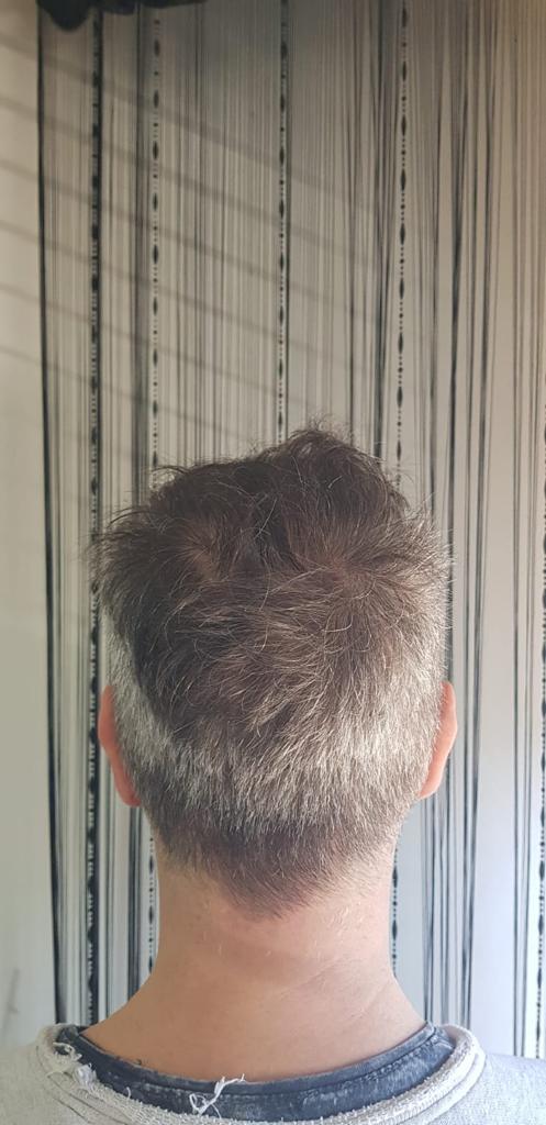 /foren/transplant/index.php/fa/57031/0/