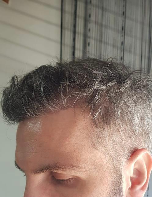 /foren/transplant/index.php/fa/57032/0/