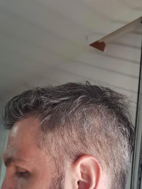 /foren/transplant/index.php/fa/57033/0/