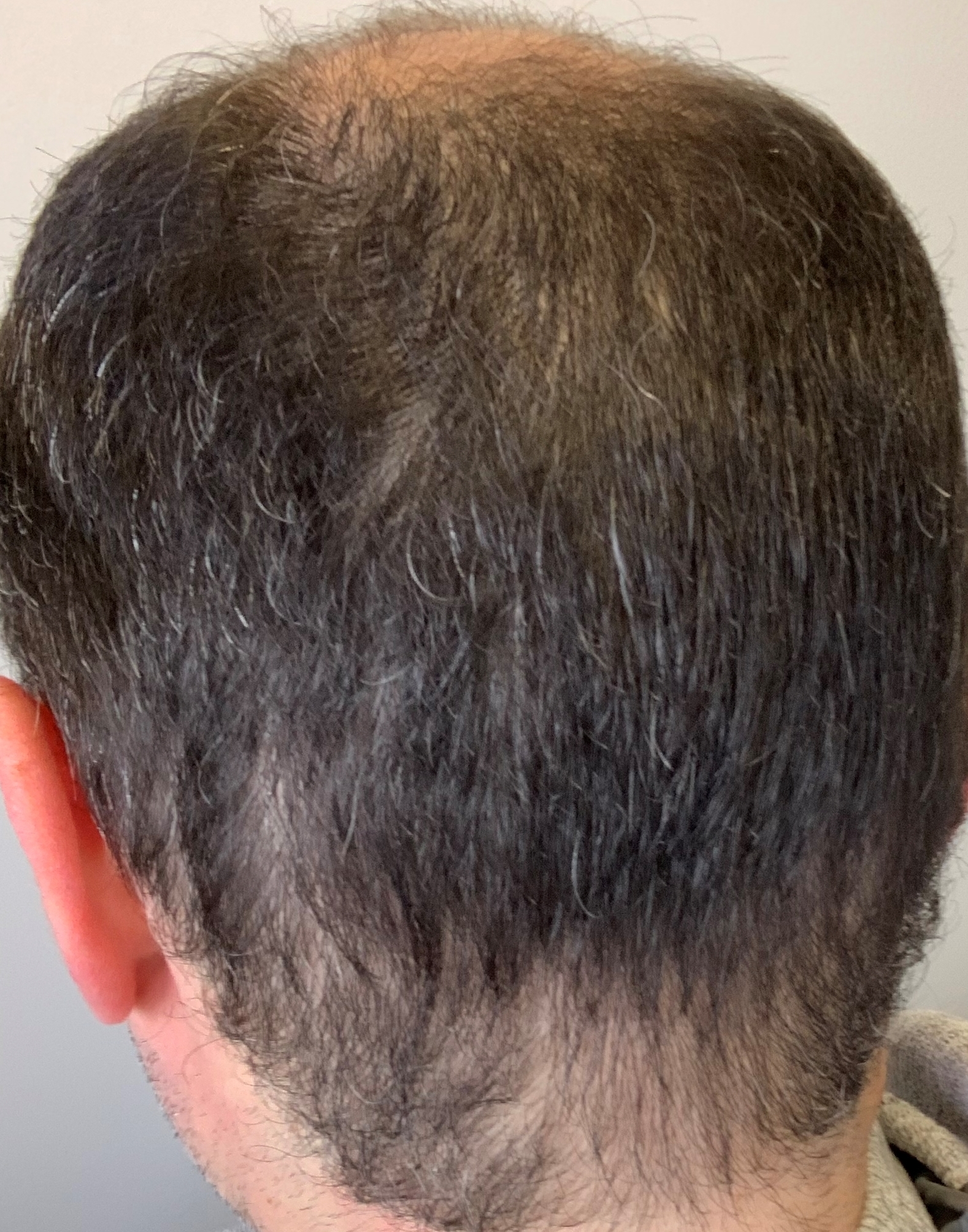 /foren/transplant/index.php/fa/57034/0/