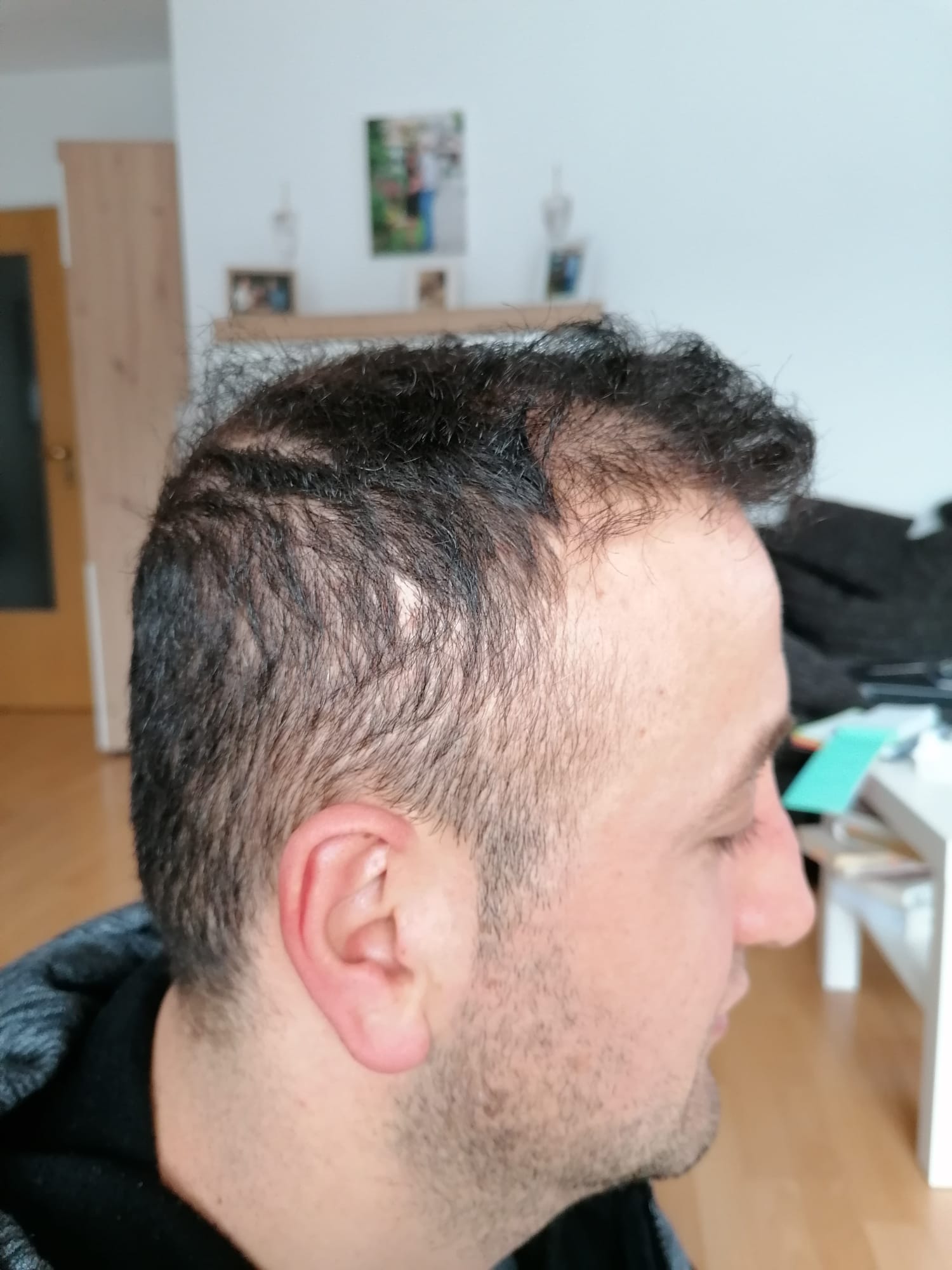 /foren/transplant/index.php/fa/57039/0/