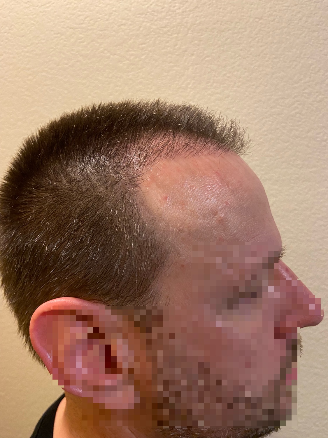 /foren/transplant/index.php/fa/57050/0/