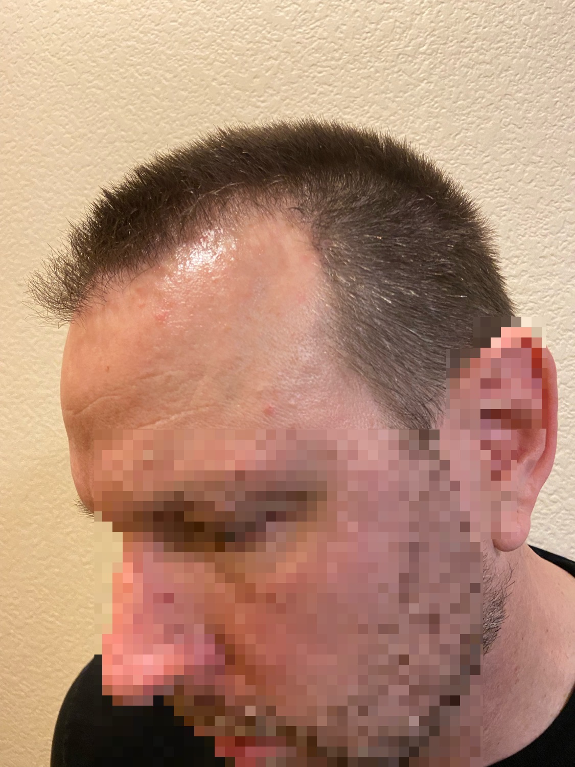 /foren/transplant/index.php/fa/57051/0/