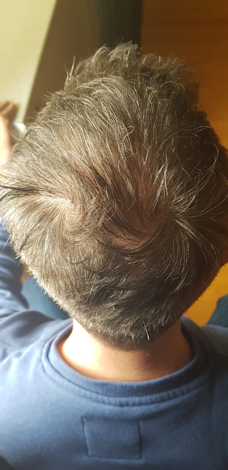 /foren/transplant/index.php/fa/57086/0/