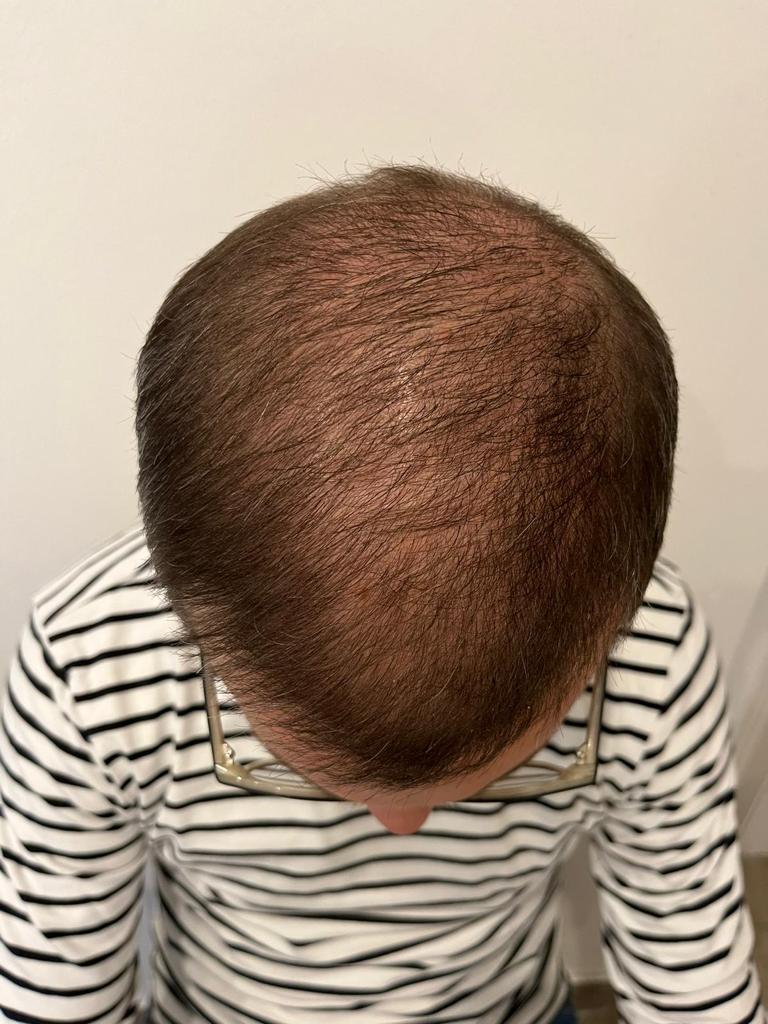 /foren/transplant/index.php/fa/57106/0/