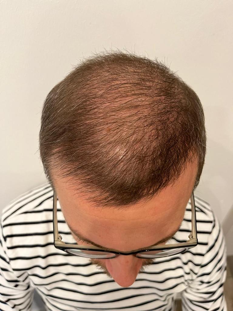 /foren/transplant/index.php/fa/57109/0/