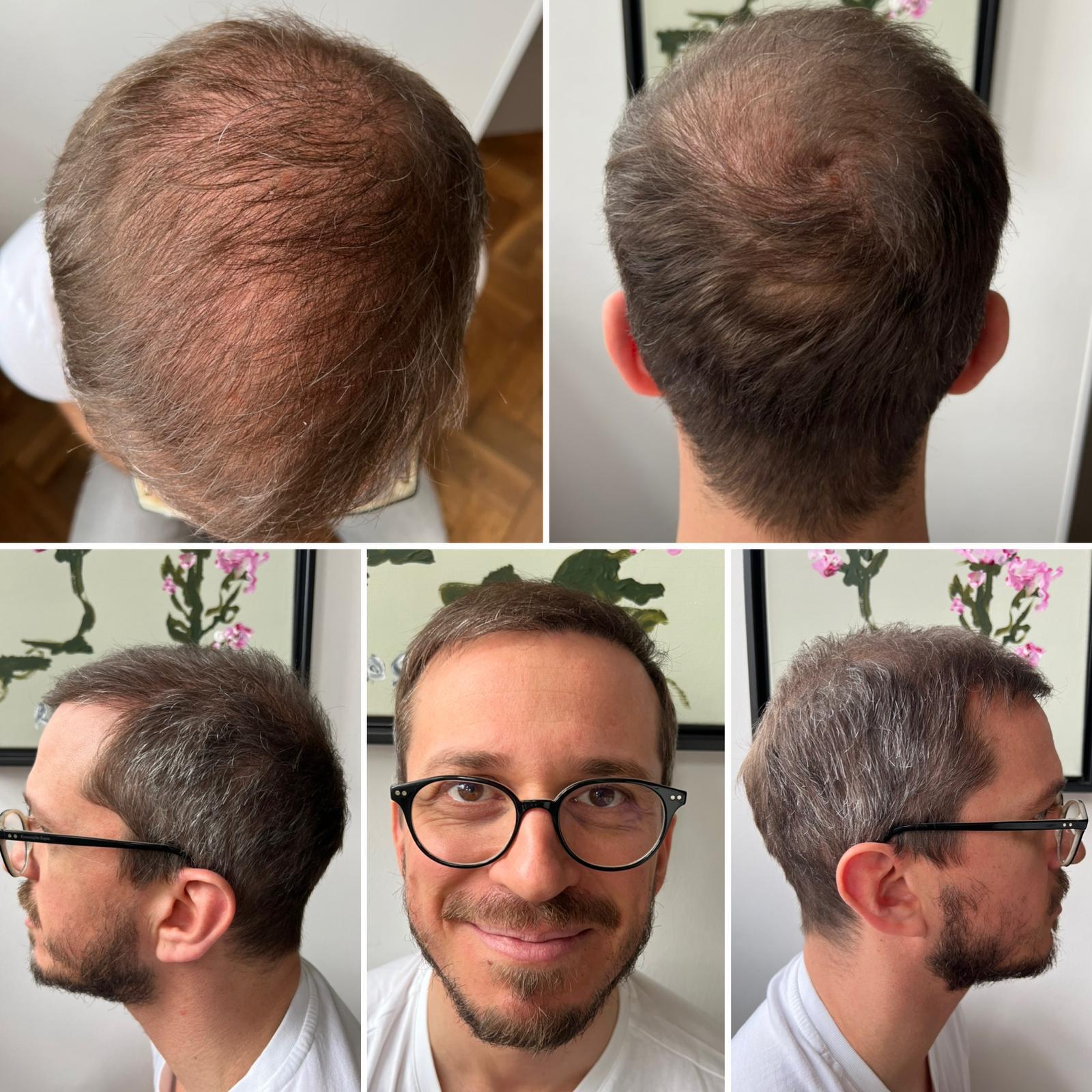 /foren/transplant/index.php/fa/57110/0/