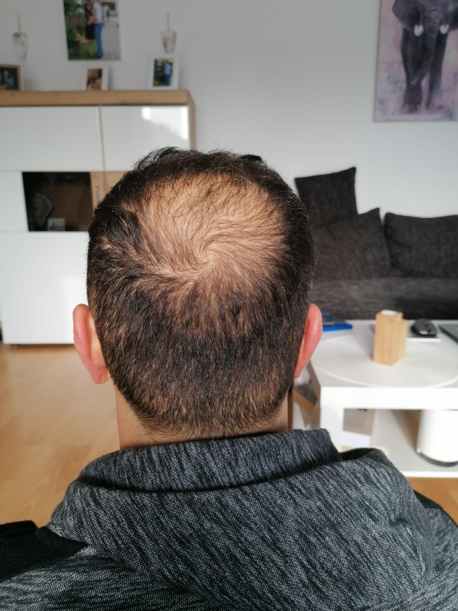 /foren/transplant/index.php/fa/57247/0/