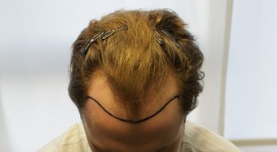 index.php/fa/5731/0/