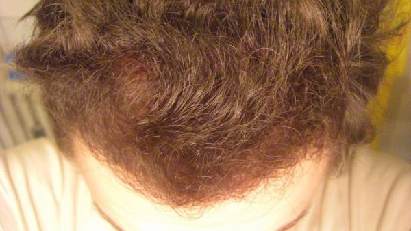 index.php/fa/5732/0/