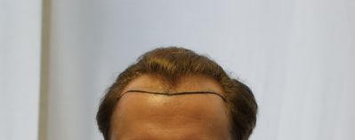 index.php/fa/5735/0/