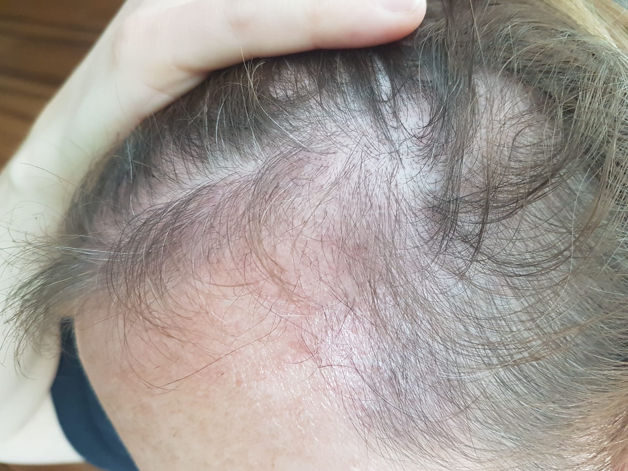 /foren/transplant/index.php/fa/57385/0/