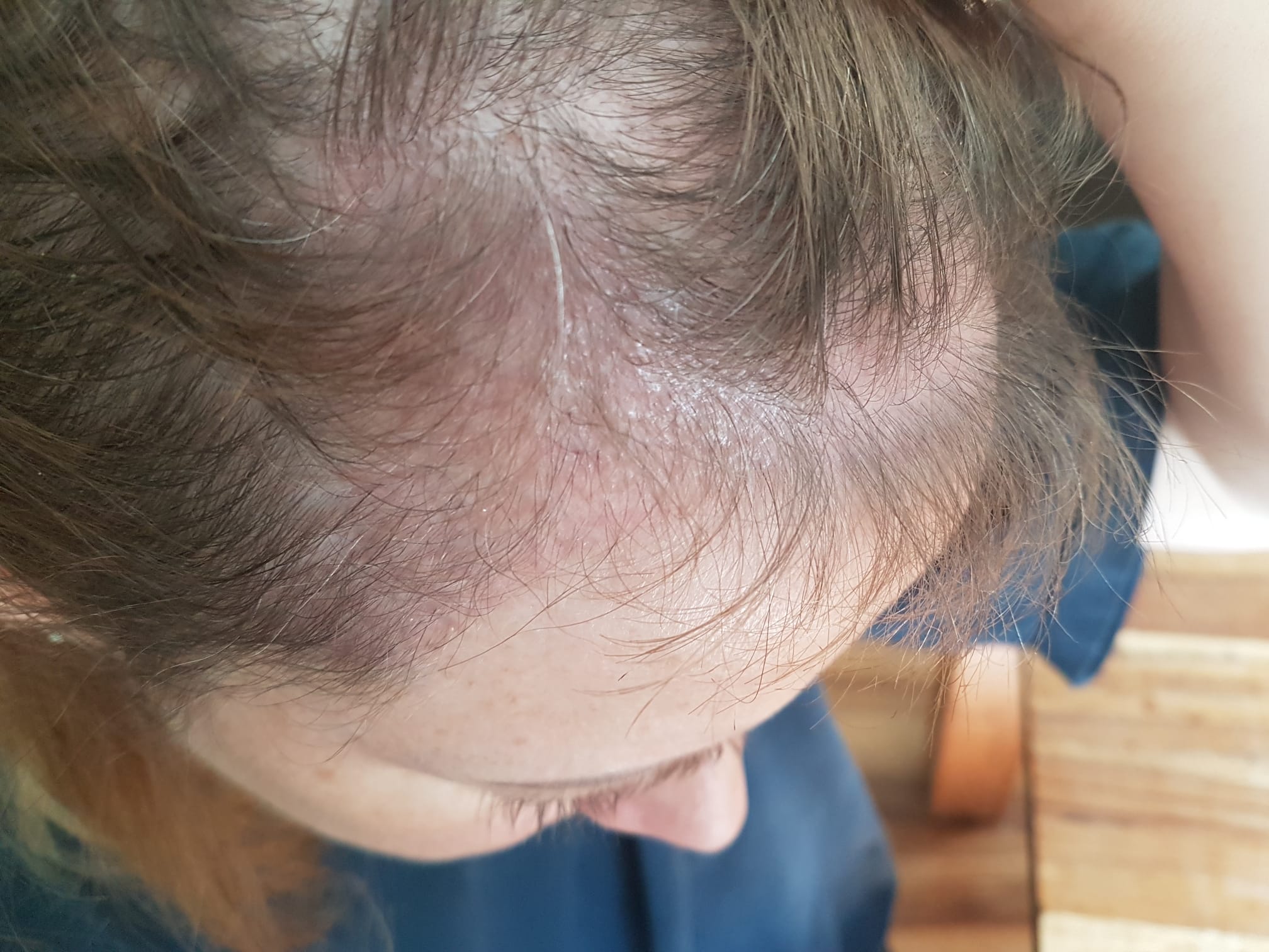 /foren/transplant/index.php/fa/57386/0/