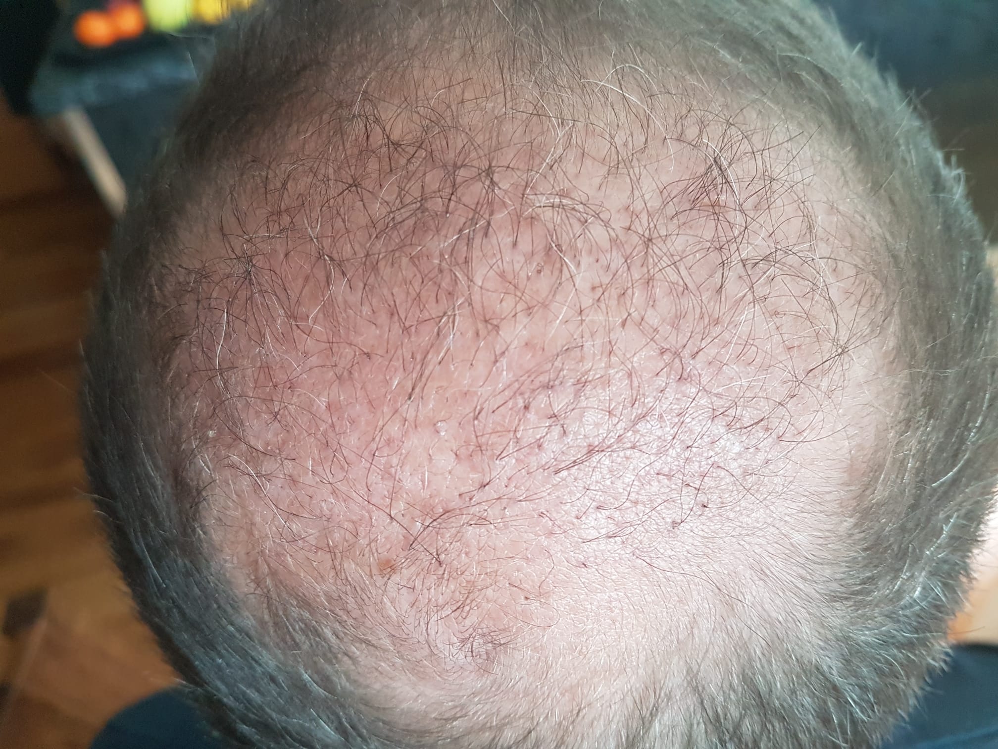 /foren/transplant/index.php/fa/57387/0/