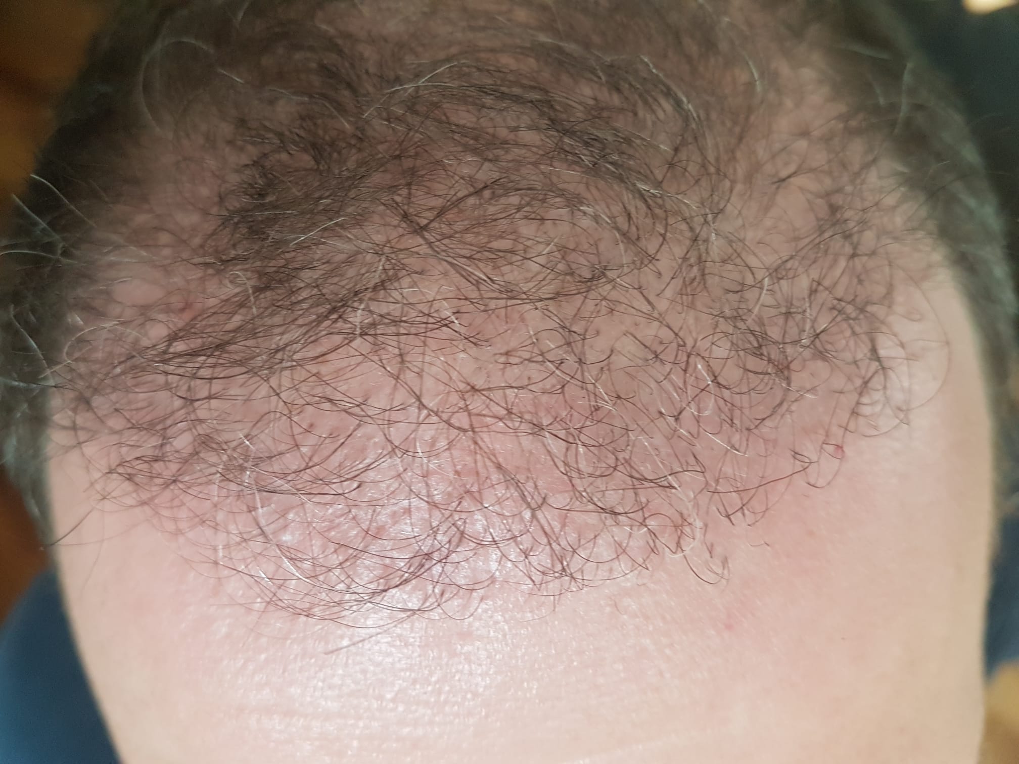 /foren/transplant/index.php/fa/57388/0/