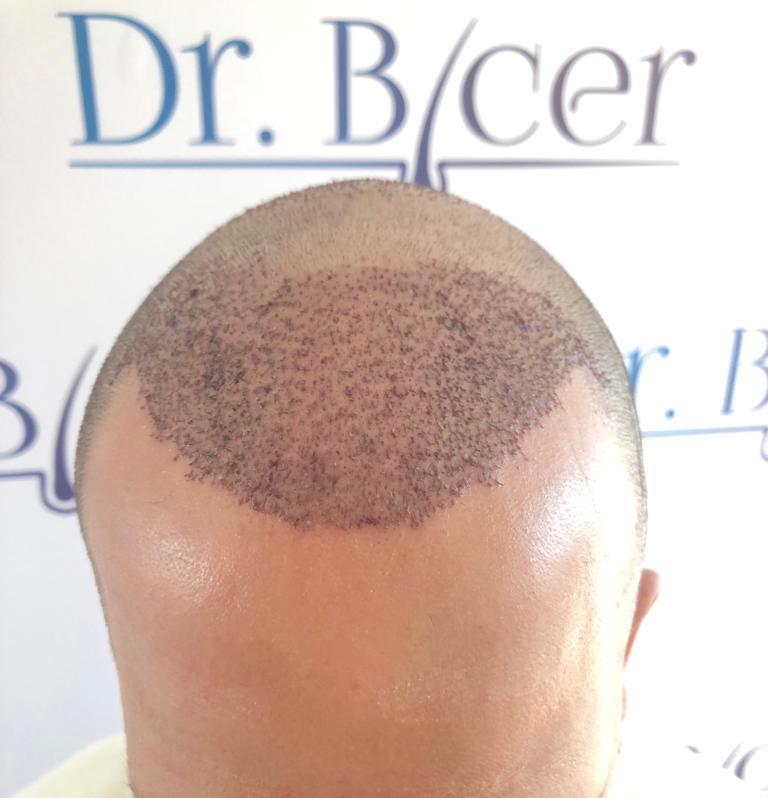 /foren/transplant/index.php/fa/57398/0/