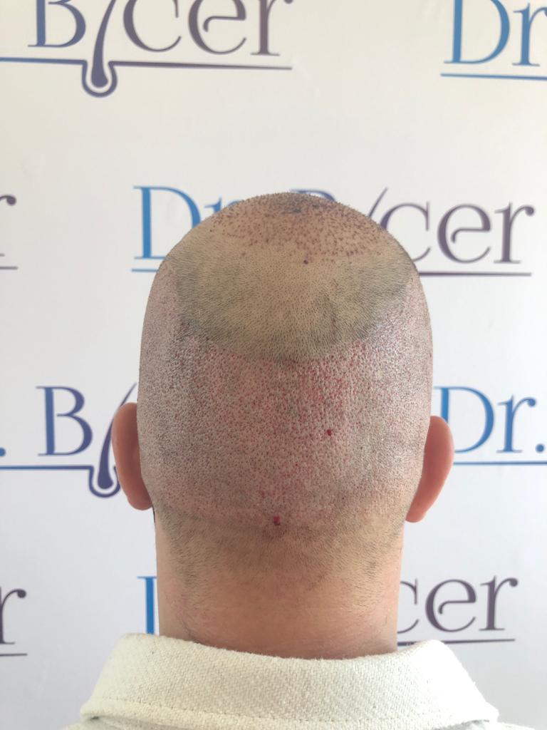 /foren/transplant/index.php/fa/57399/0/