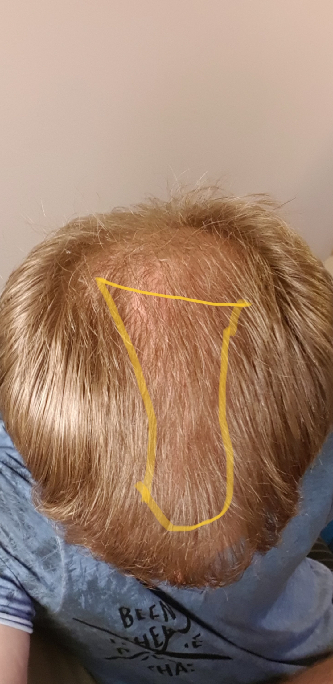 /foren/transplant/index.php/fa/57423/0/