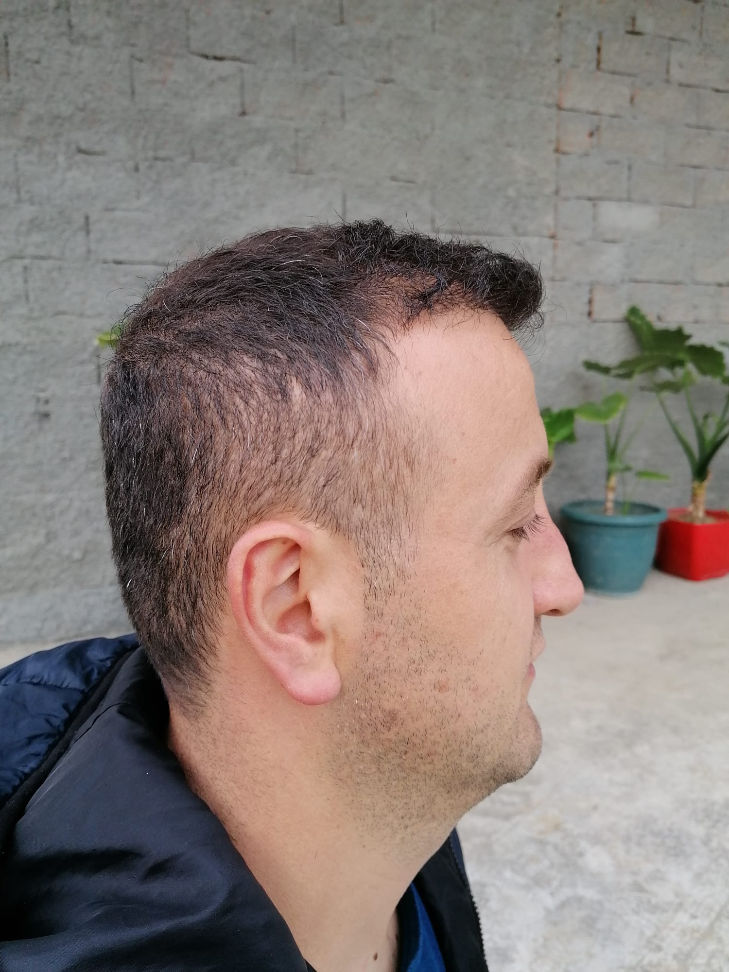 /foren/transplant/index.php/fa/57425/0/