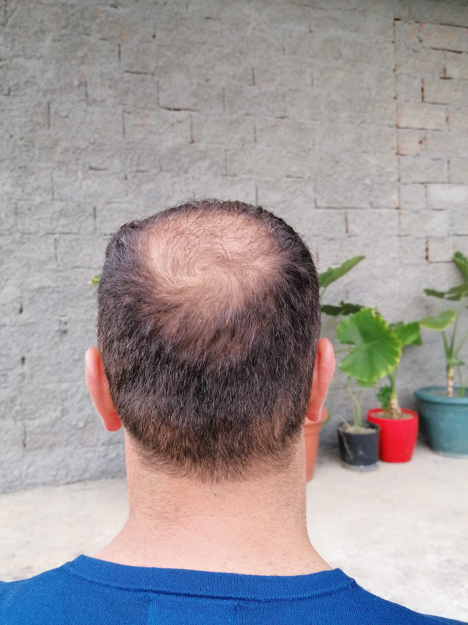 /foren/transplant/index.php/fa/57426/0/