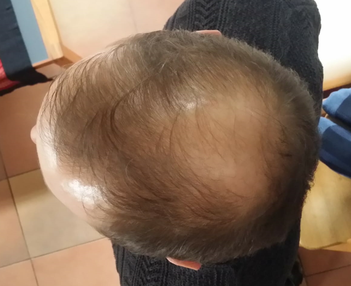 /foren/transplant/index.php/fa/57574/0/