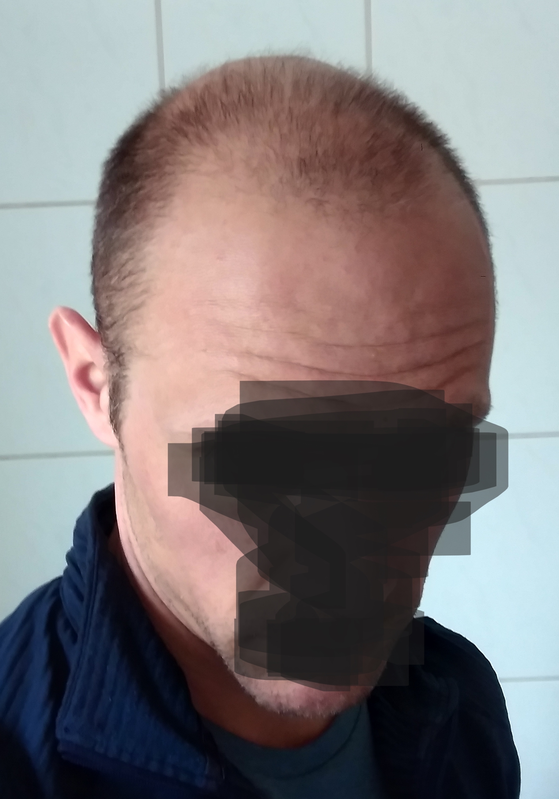 /foren/transplant/index.php/fa/57577/0/