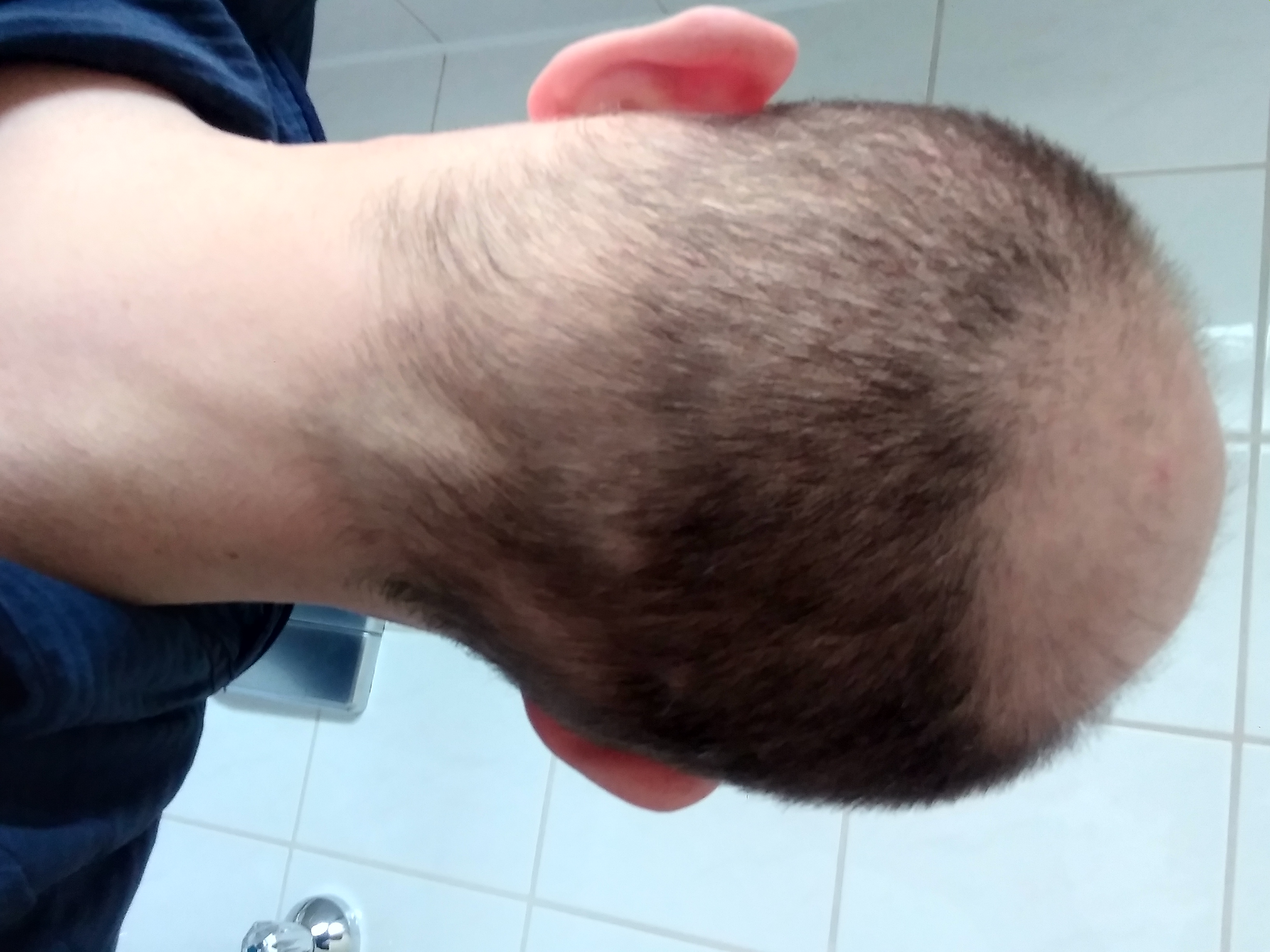 /foren/transplant/index.php/fa/57579/0/