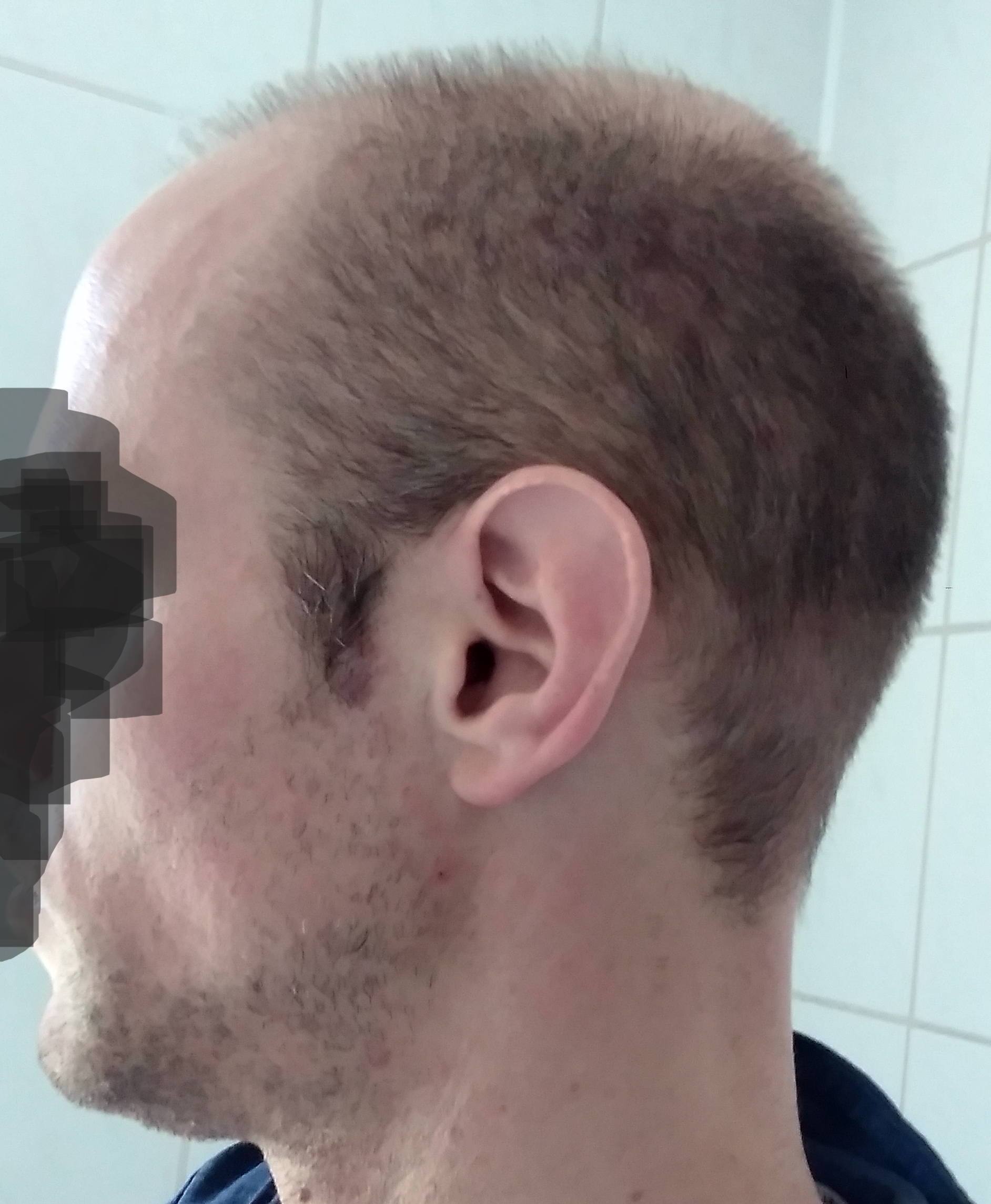 /foren/transplant/index.php/fa/57582/0/