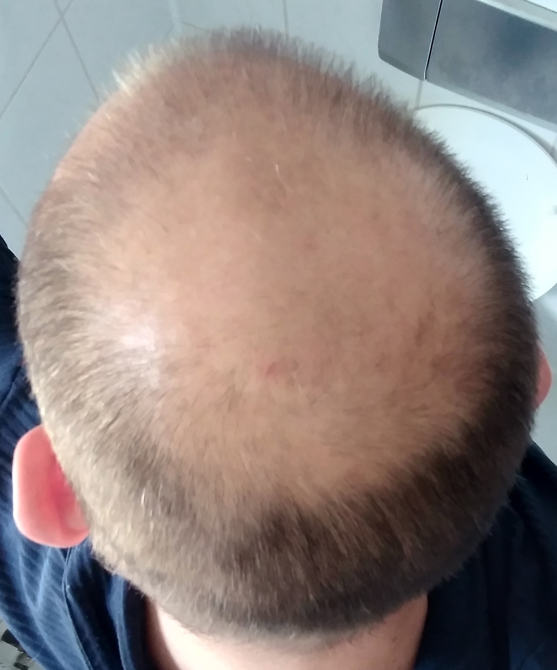 /foren/transplant/index.php/fa/57583/0/