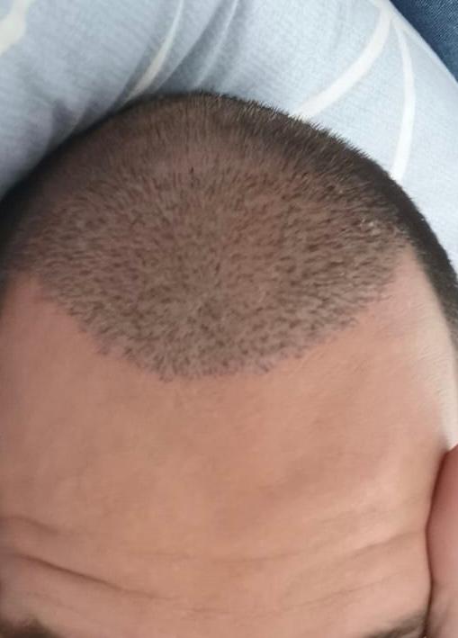 /foren/transplant/index.php/fa/57590/0/