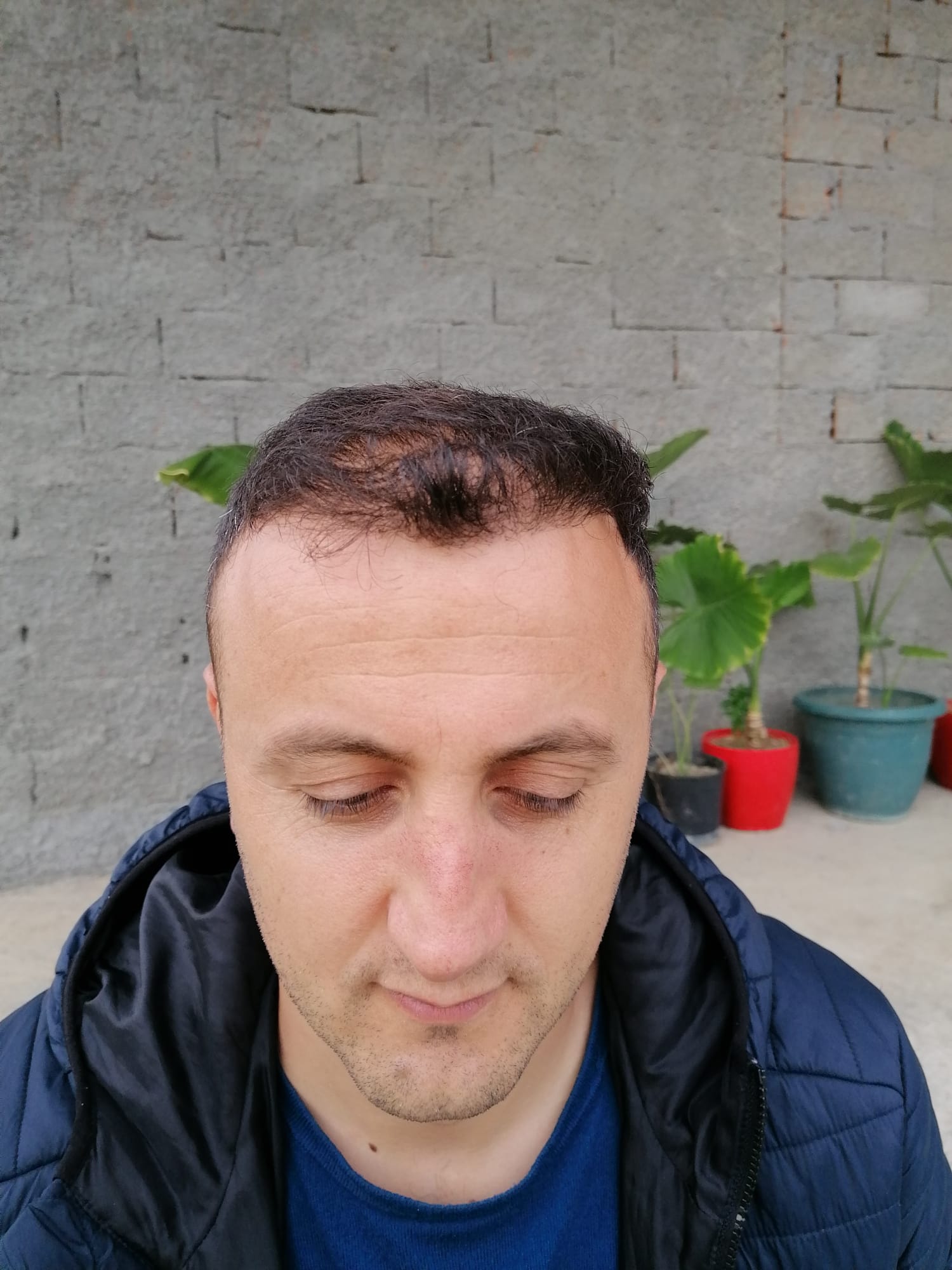 /foren/transplant/index.php/fa/57594/0/