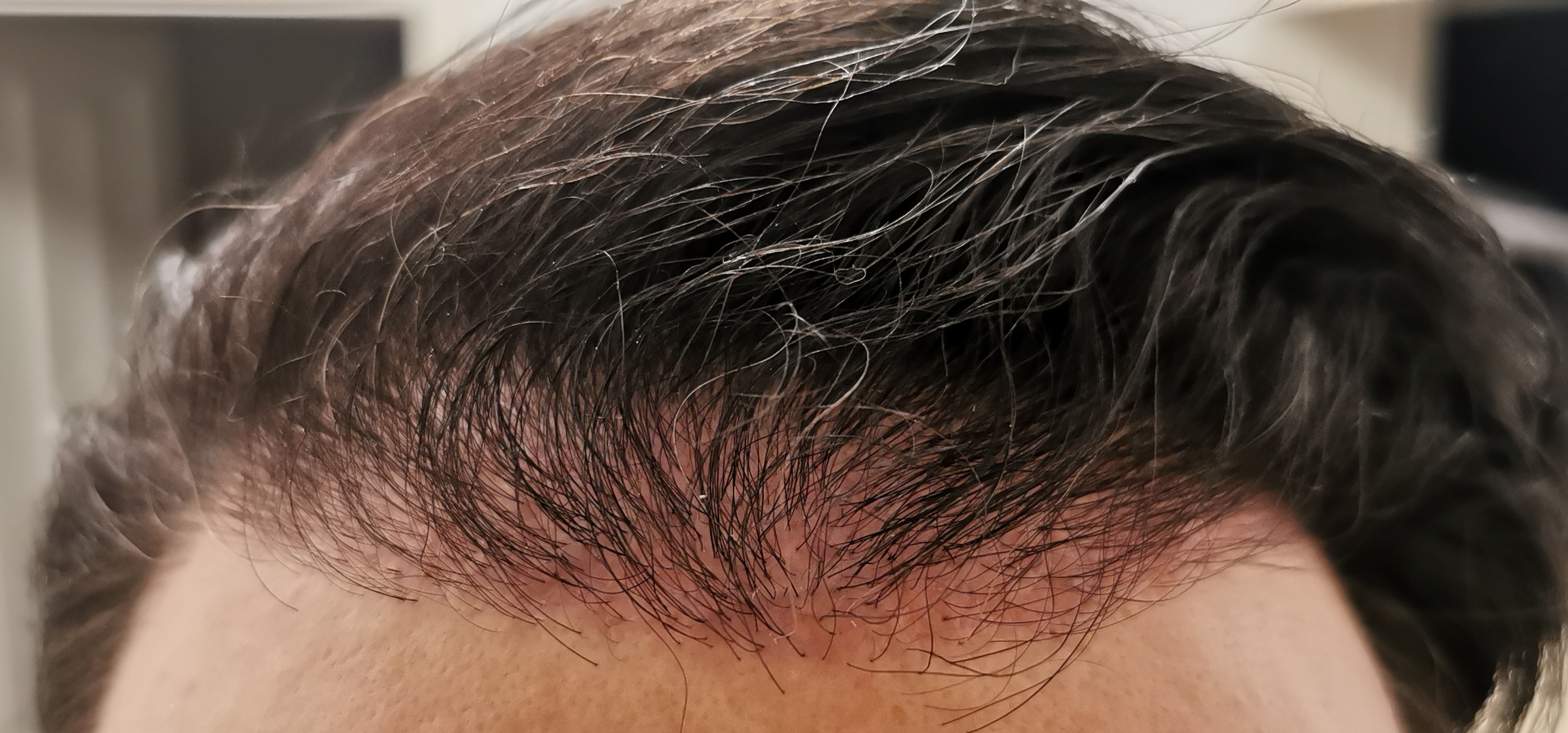 /foren/transplant/index.php/fa/57630/0/