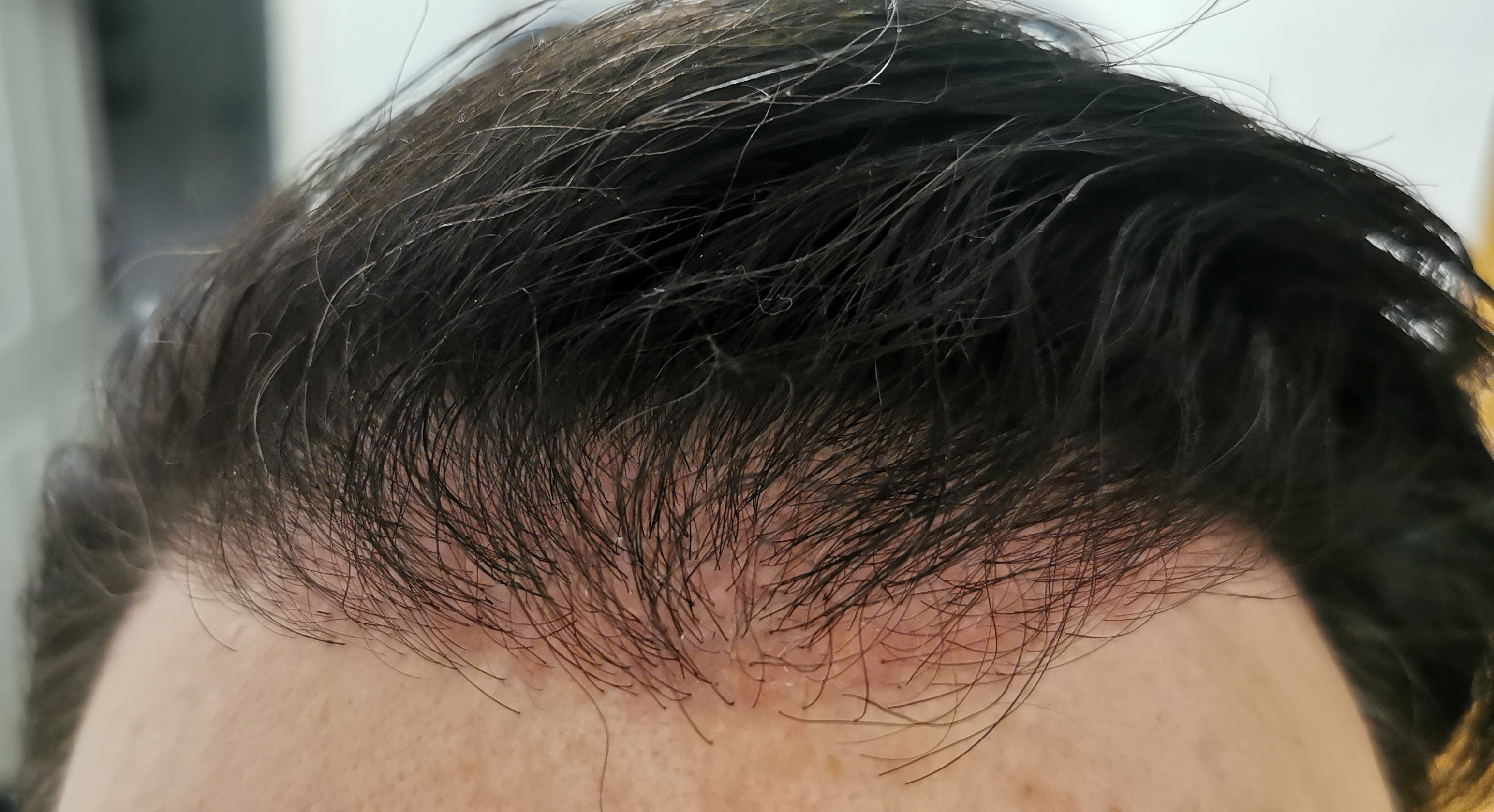 /foren/transplant/index.php/fa/57631/0/